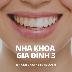 Nha khoa tốt nhất Gò Vấp