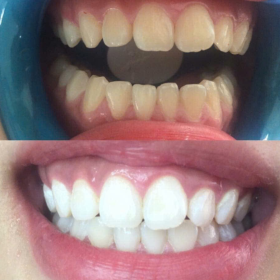Chị Hồng Gò Vấp
