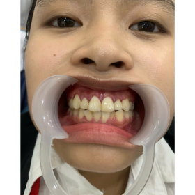 Chị My Gò Vấp