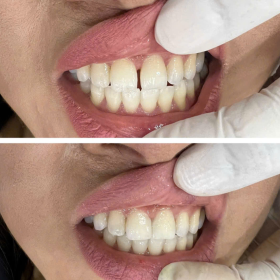 Chị Đào Gò Vấp
