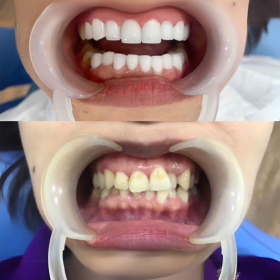 Chị Ly Gò Vấp