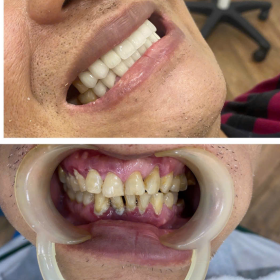 Chú Được Gò Vấp
