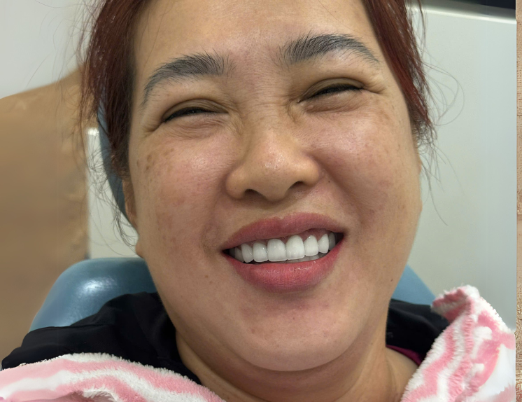 Răng sứ DD Bio 2,800,000