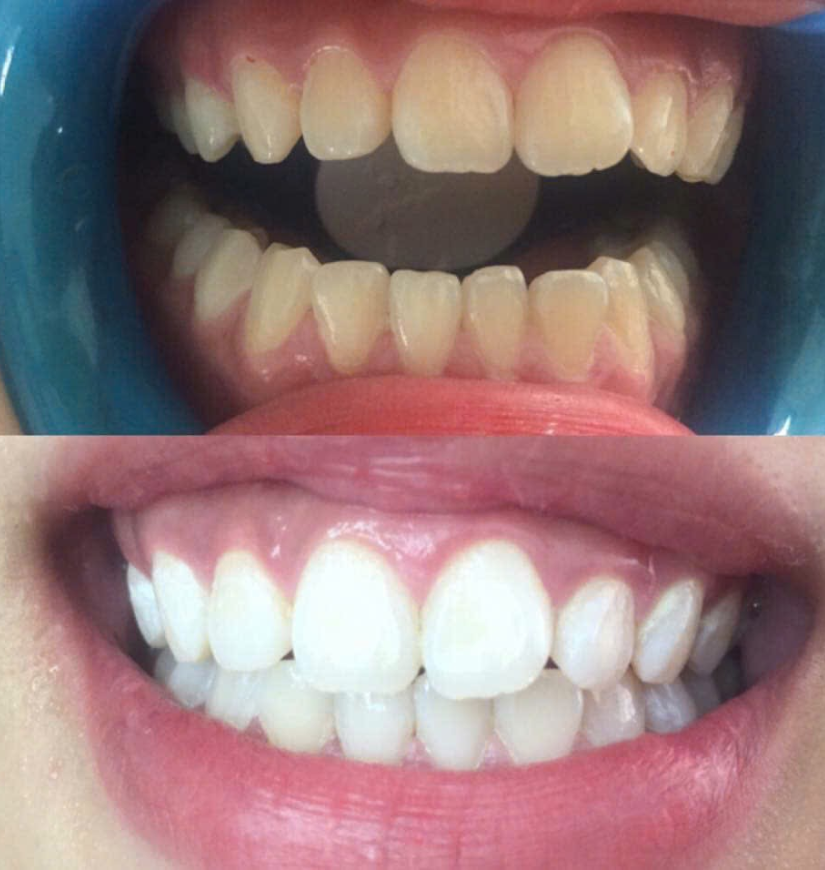 Chị Hồng Gò Vấp
