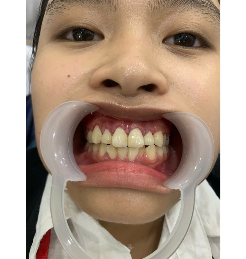 Chị My Gò Vấp