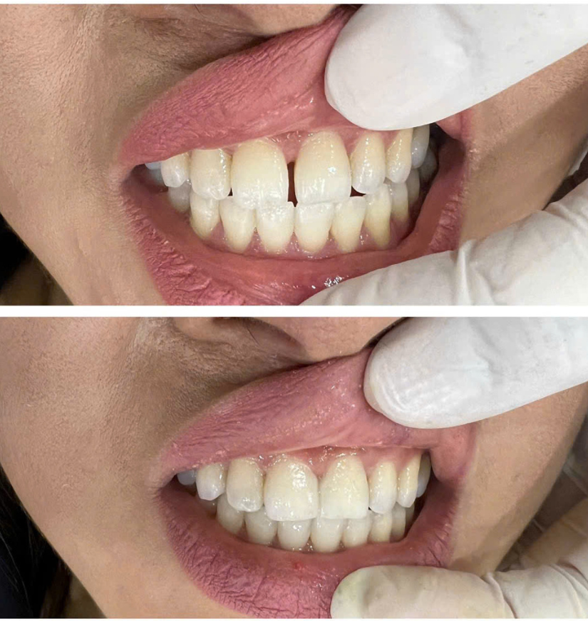 Chị Đào Gò Vấp