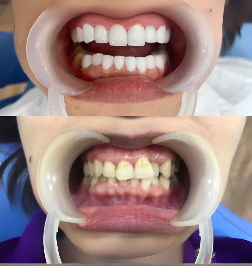 Chị Ly Gò Vấp