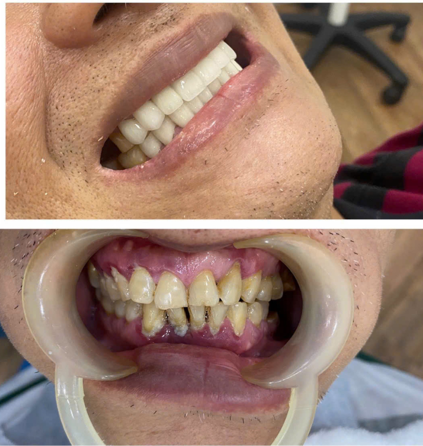 Chú Được Gò Vấp