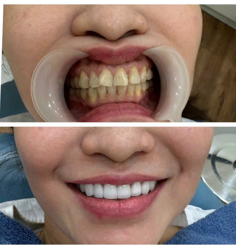 Chị Hạnh Hóc Môn